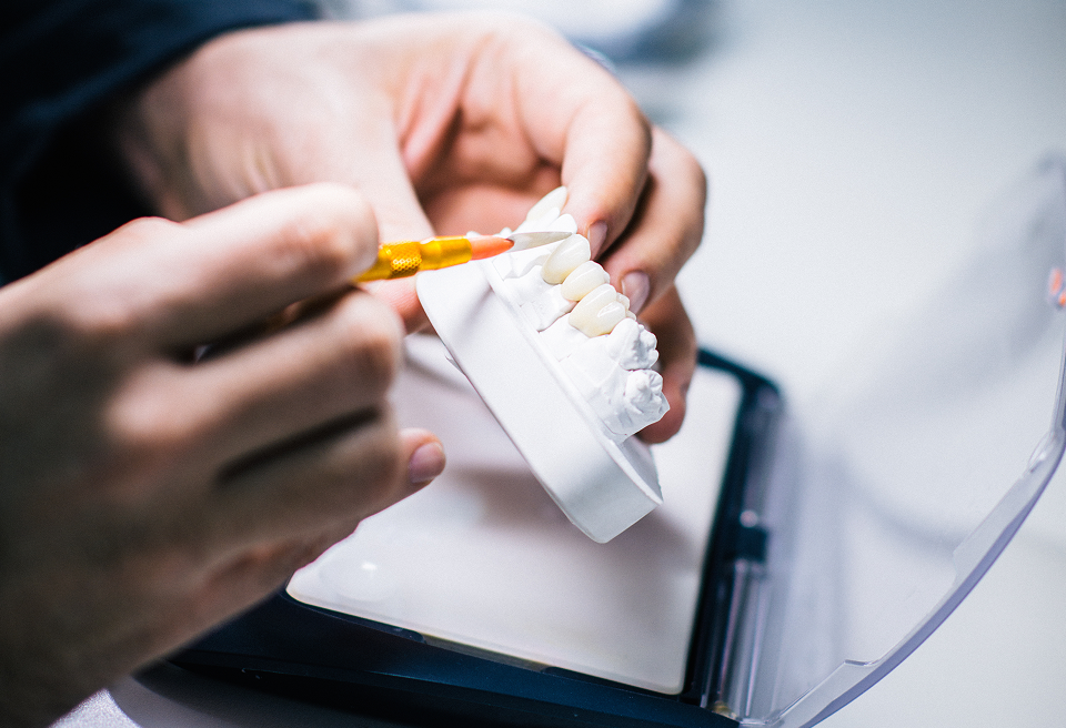 On-Site Dental Laboratory for Dental Veneers